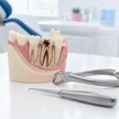 9c762870-59e5-45af-af6c-5112e427adba-09-complex-permanent-tooth-extraction.jpg